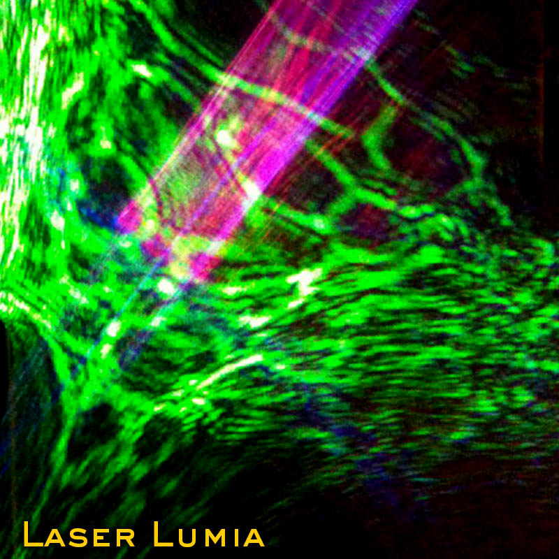 Laser Lumia